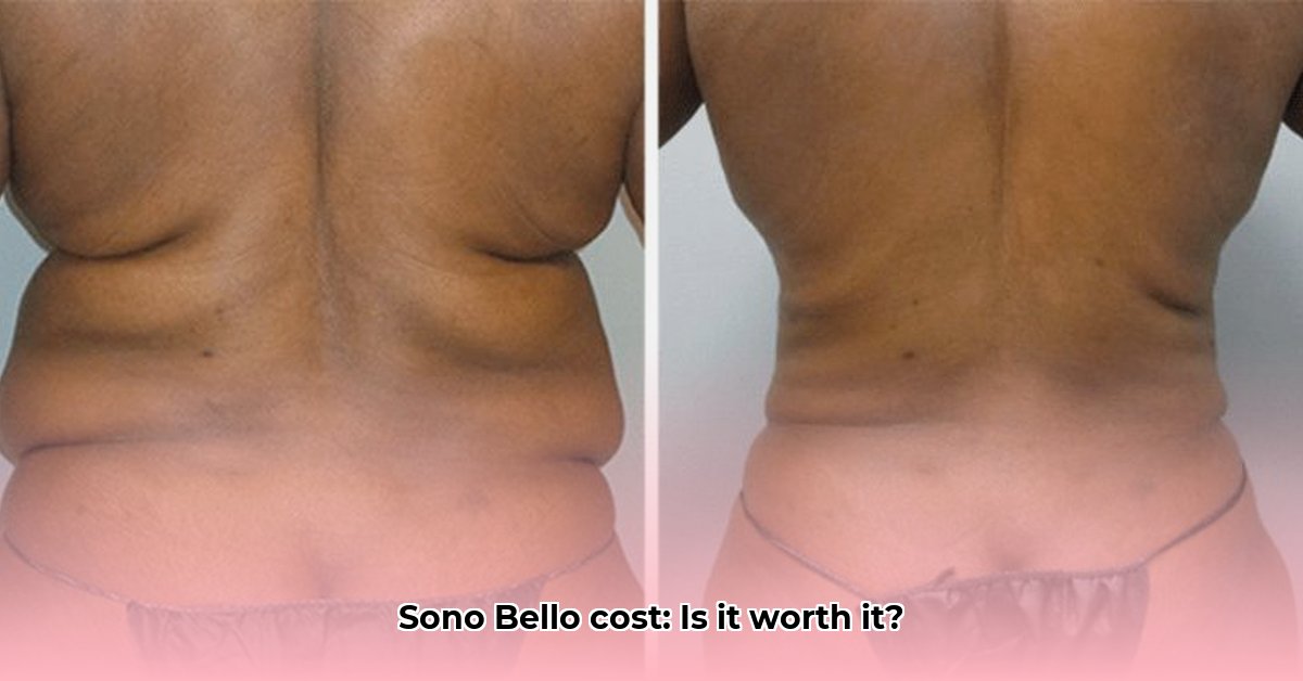 how-much-for-sonobello